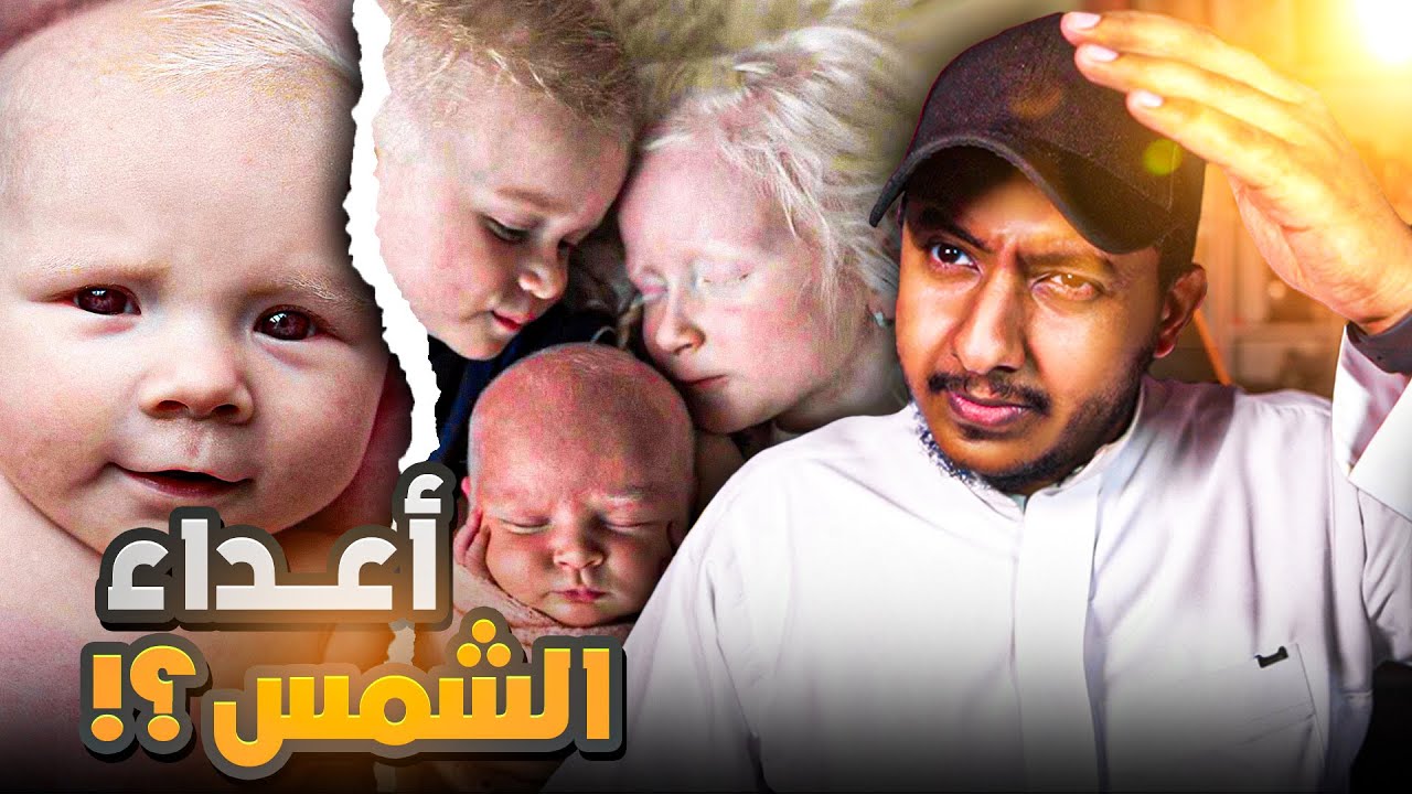 لا يستطيعون العيش الا في الظلام | بشر وليسو اشباح