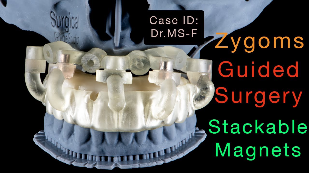 our Stackable Guides Just WORK!