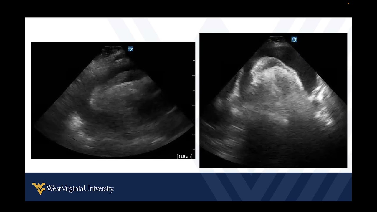 M3 POCUS Cases IM Cardiopulmonary