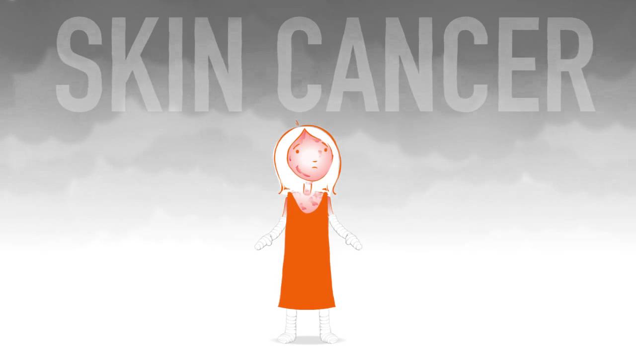 What is EB animation