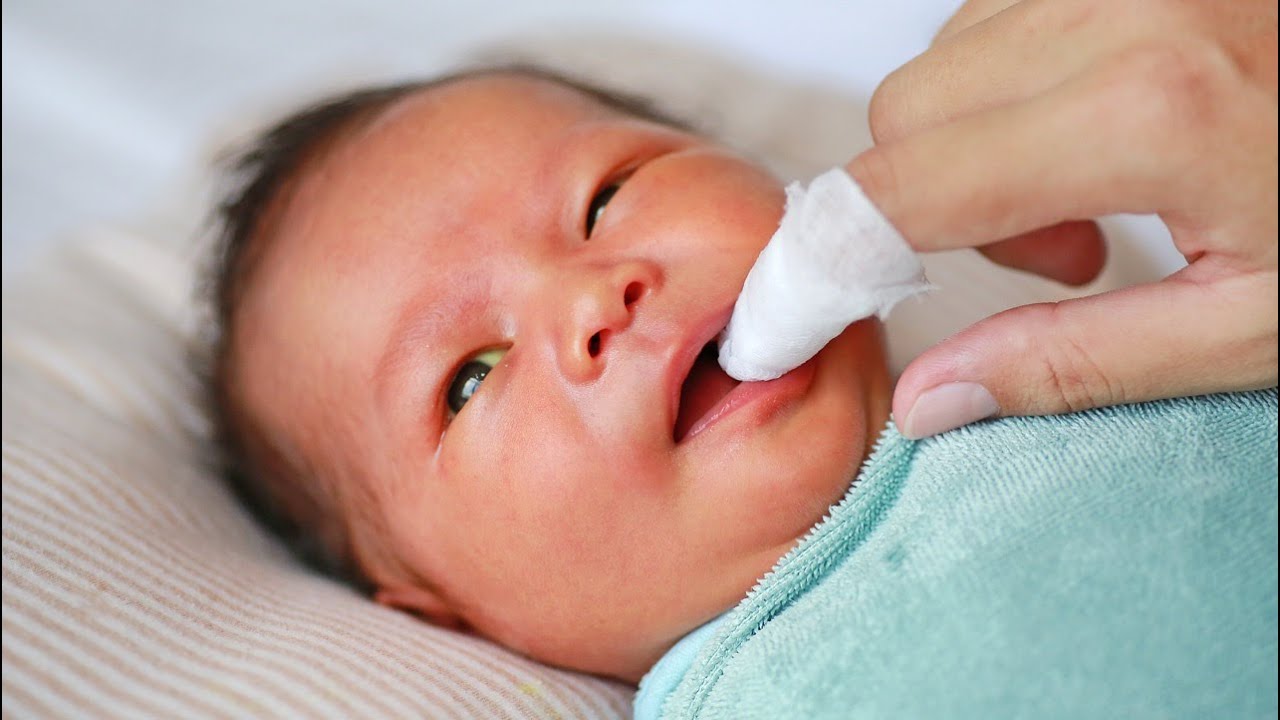 Ci&scaron;ćenje jezika bebe kada beba ima soor (mlečac)