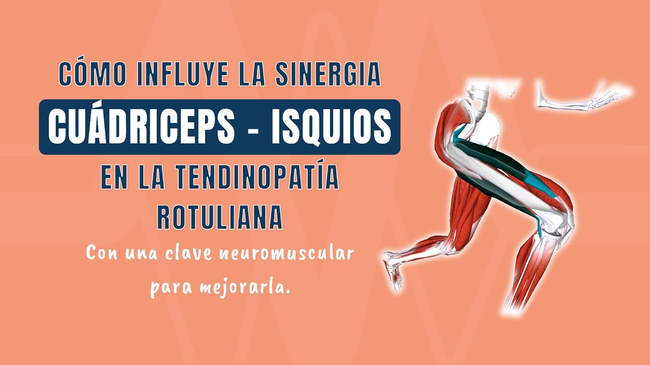 Cómo influye la sinergia cuádriceps–isquios en la tendinopatía rotuliana