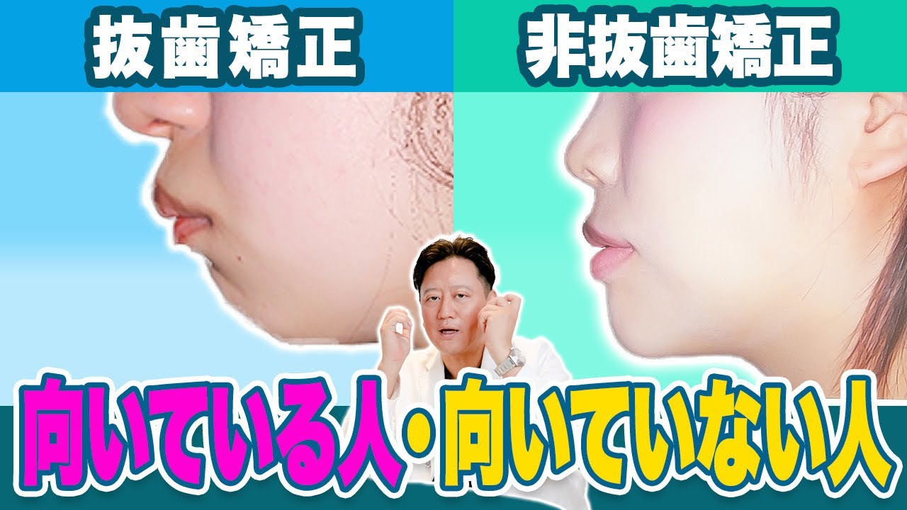 矯正治療の悩み… 抜歯・抜歯の選び方と美しいEラインの作り方を症例を元にお話しします【審美歯科 歯列矯正 歯並び 歯医者 口ゴボ】
