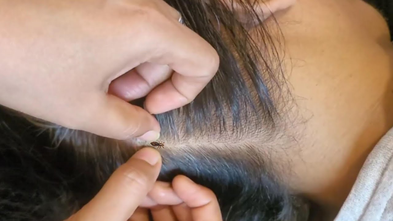 ASMR Relax & Sleep Fast, Gentle Scalp Checking For DEEP Calm✨🌿