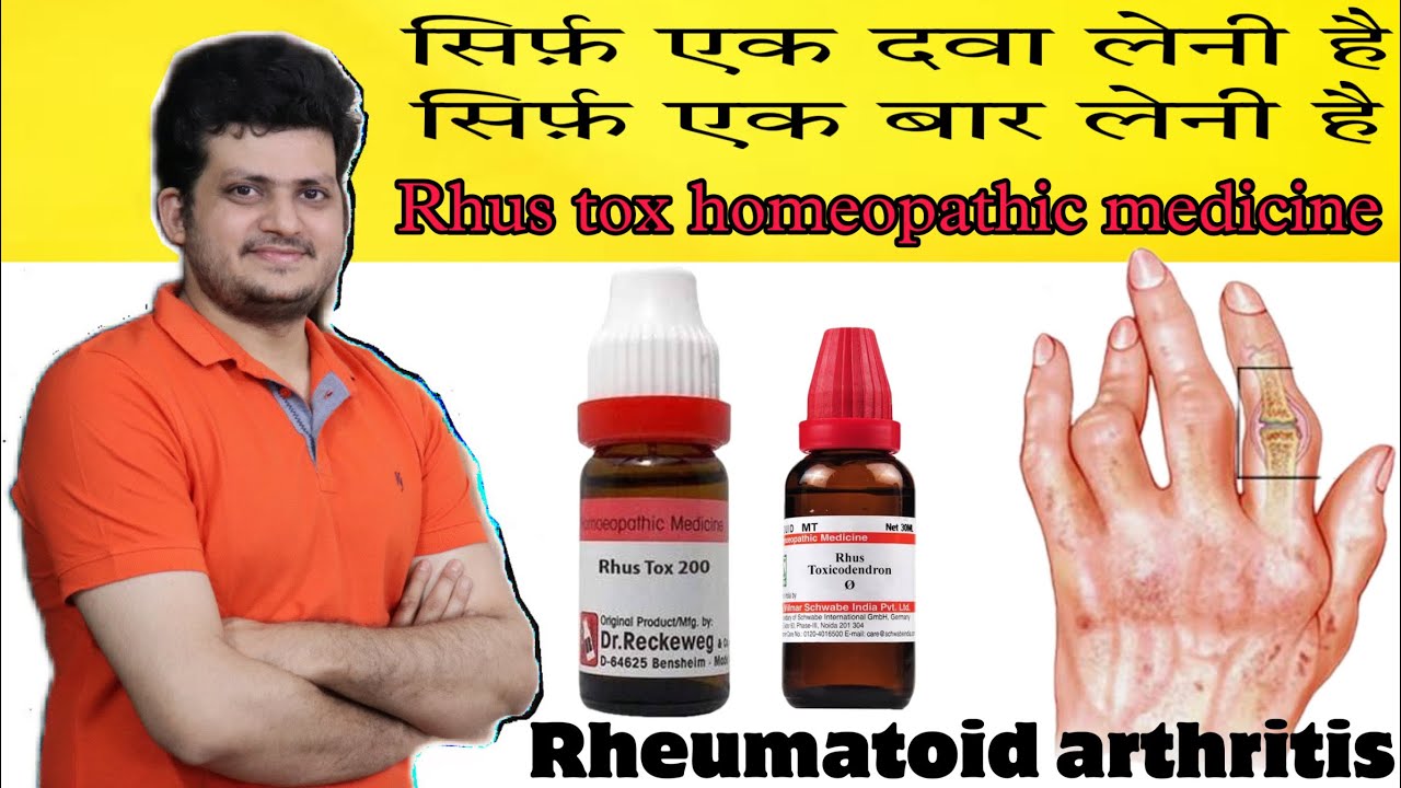 Rhus Tox Homeopathic Medicine For Rheumatoid Arthritis | वात रोग की सबसे अच्छी होम्योपैथिक दवा |