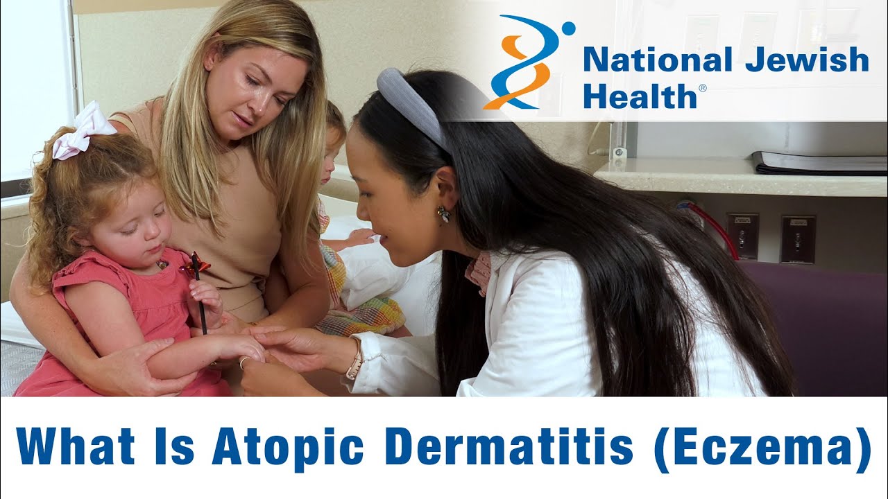 Atopic Dermatitis (Eczema) Tips from National Jewish Health You Can Trust  #eczema #atopicdermatitis