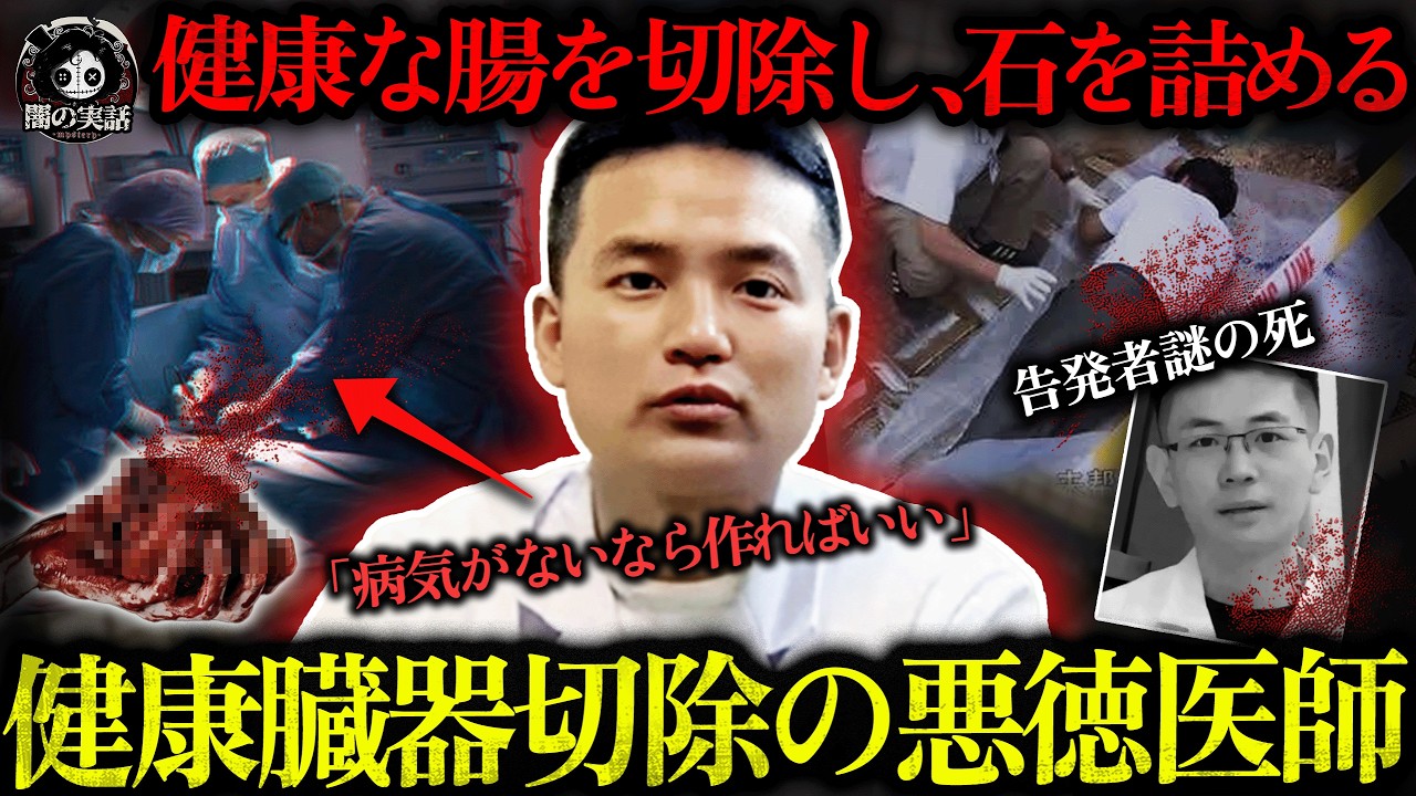 【胸糞】健康な腸を切除し、体内に石を詰める…中国トップ病院に潜む悪徳医師の異常すぎる正体【闇の実話ミステリー】