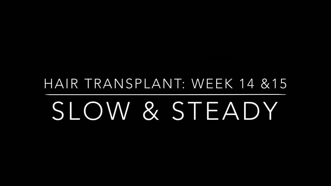 HAIR TRANSPLANT JOURNEY - WEEK 14 & 15 - HLC Ankara