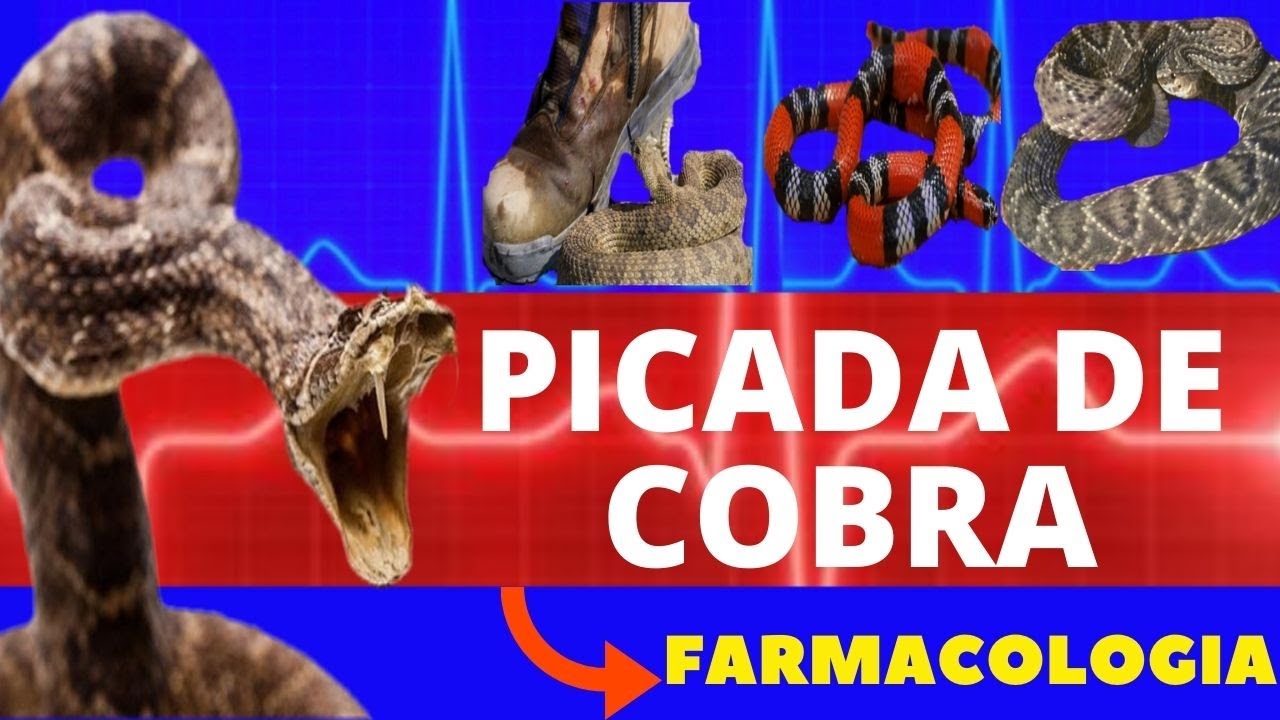 PICADA DE COBRA -(JARARACA, CASCAVEL,COBRA CORAL E SURUCUCU) O QUE ACONTECE? ANTIOFÍDICO E SOLUÇÃO