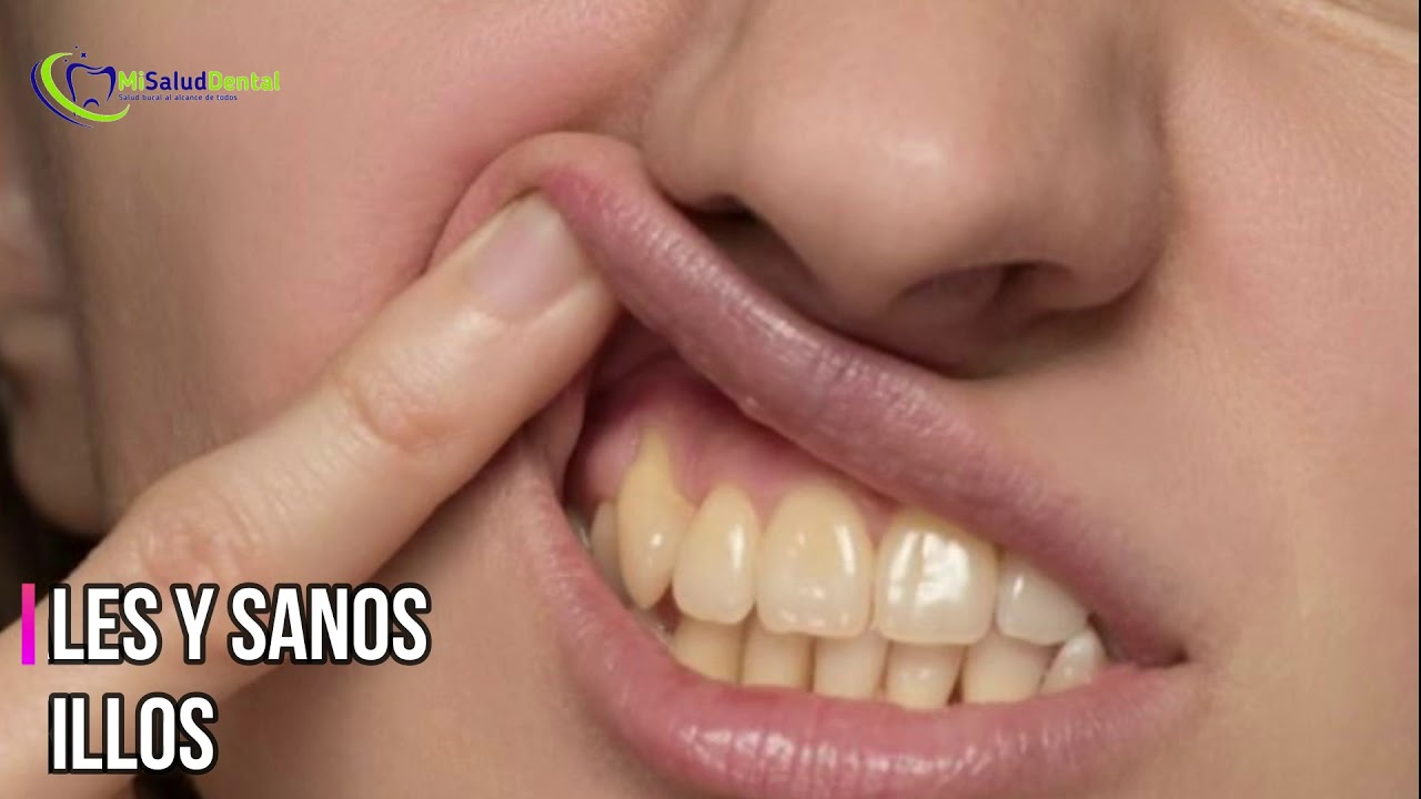 SABIAS QUE?? DATOS CURIOSOS SOBRE TU BOCA