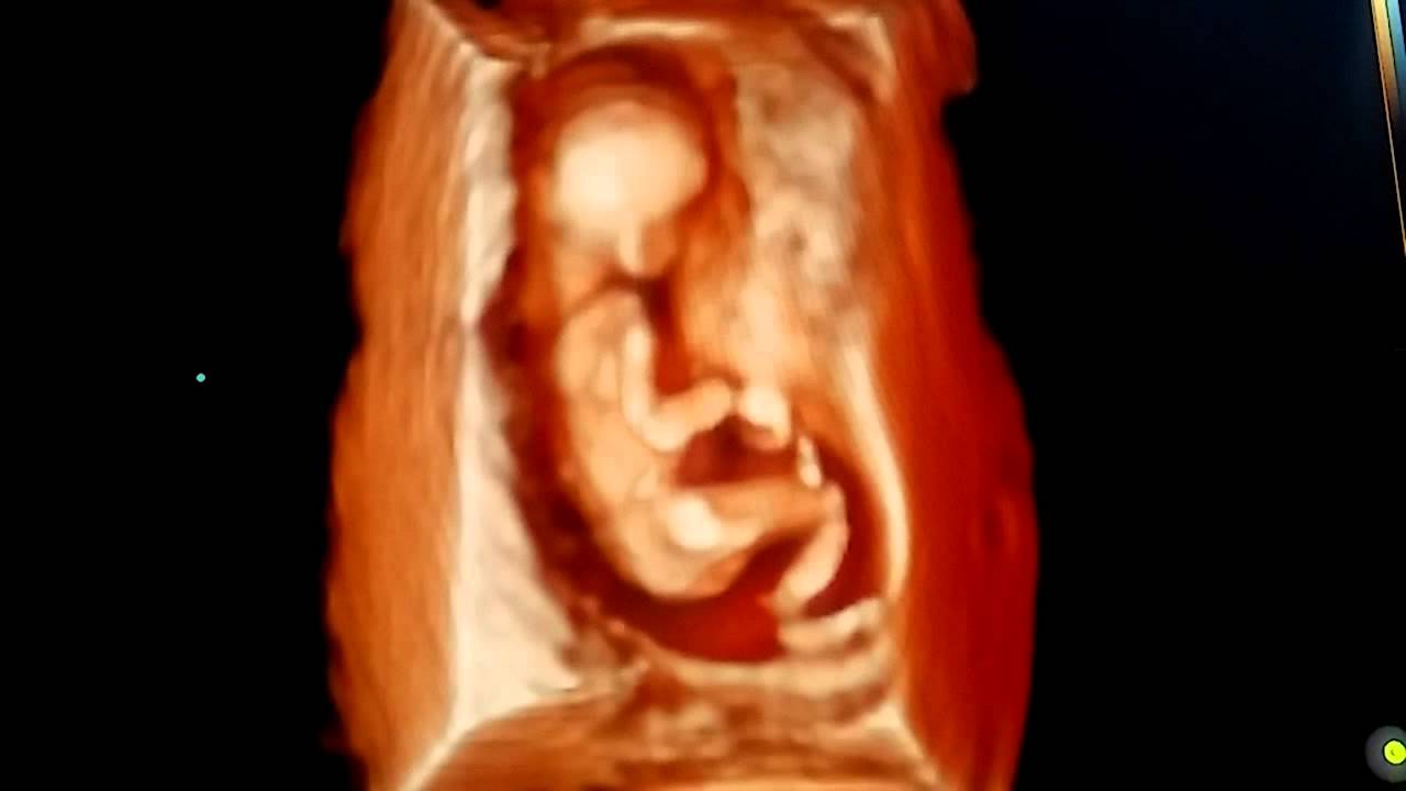 Should I be able to feel my baby at 15 weeks?