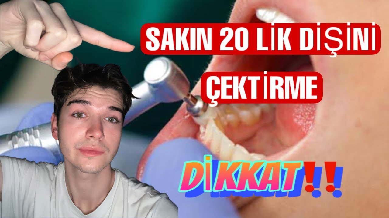 ⚠️BU VİDEOYU İZLEMEDEN KESİNLİKLE AMA KESİNLİKLE 20lik DİŞLERİNİZİ ALDIRMAYIN⚠️