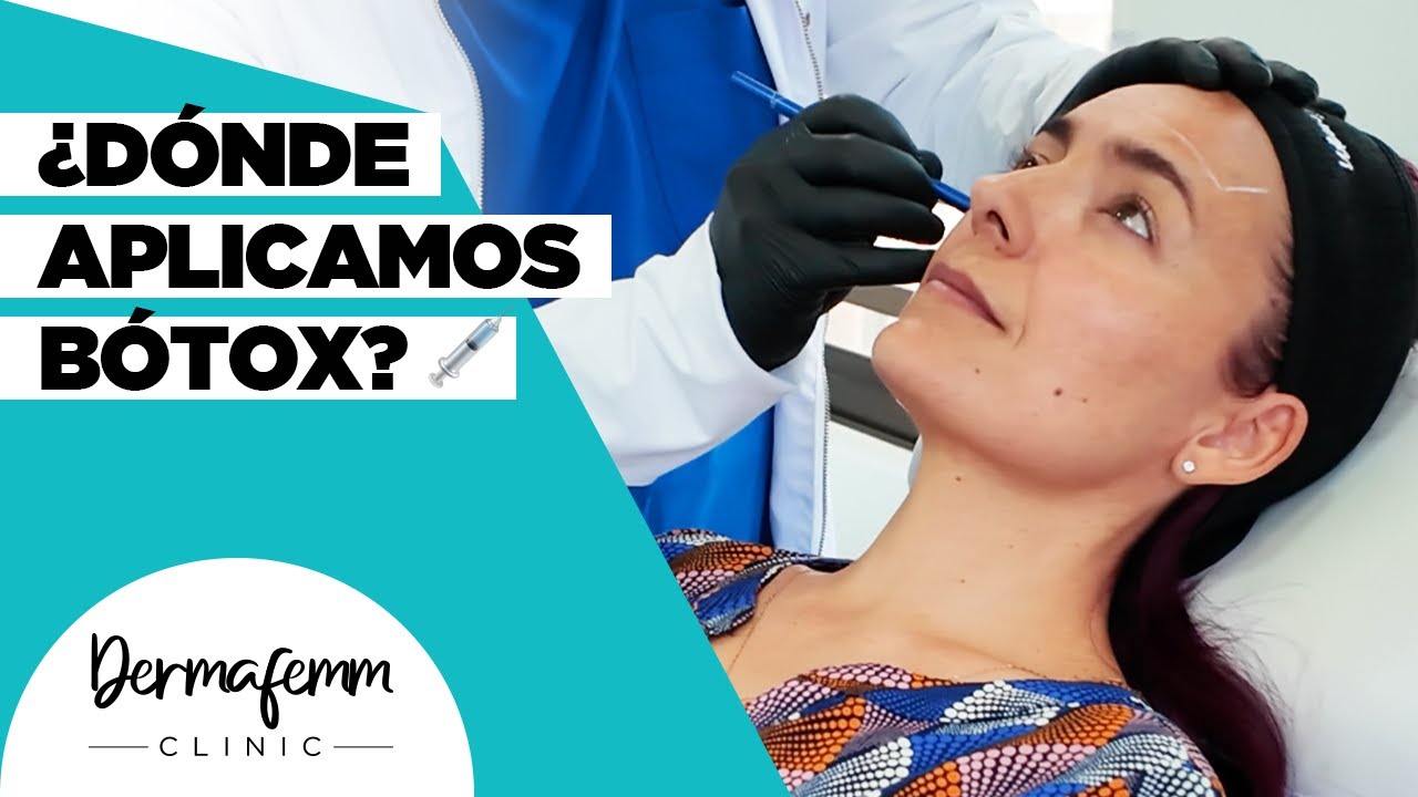 ATENÚA LAS ARRUGAS CON TOXINA BOTULÍNICA - Aplicación en nuestra amiga Janis Pope