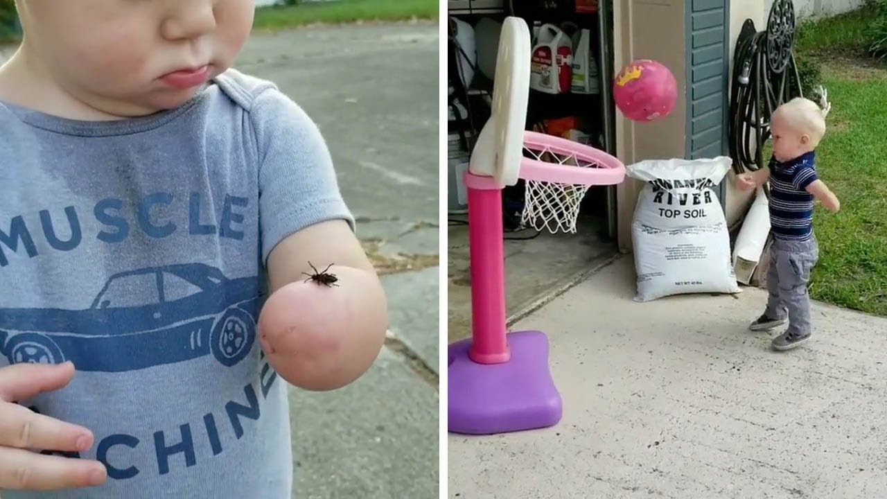 Adorable Toddler Has 'Lucky Fin'
