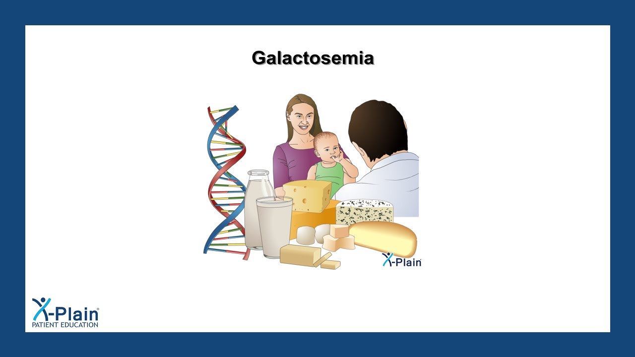 Galactosemia