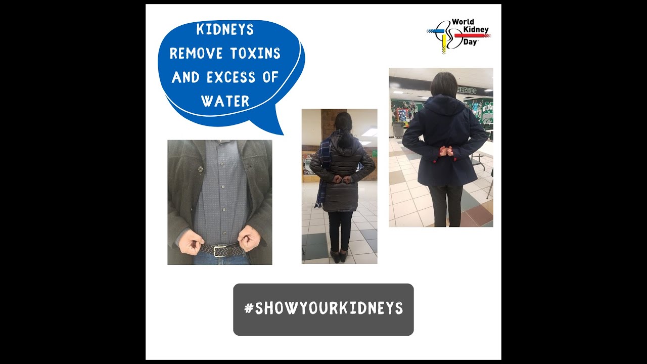 #ShowYourKidneys #Challenge on #worldkidneyday by #DrAnupamRoy