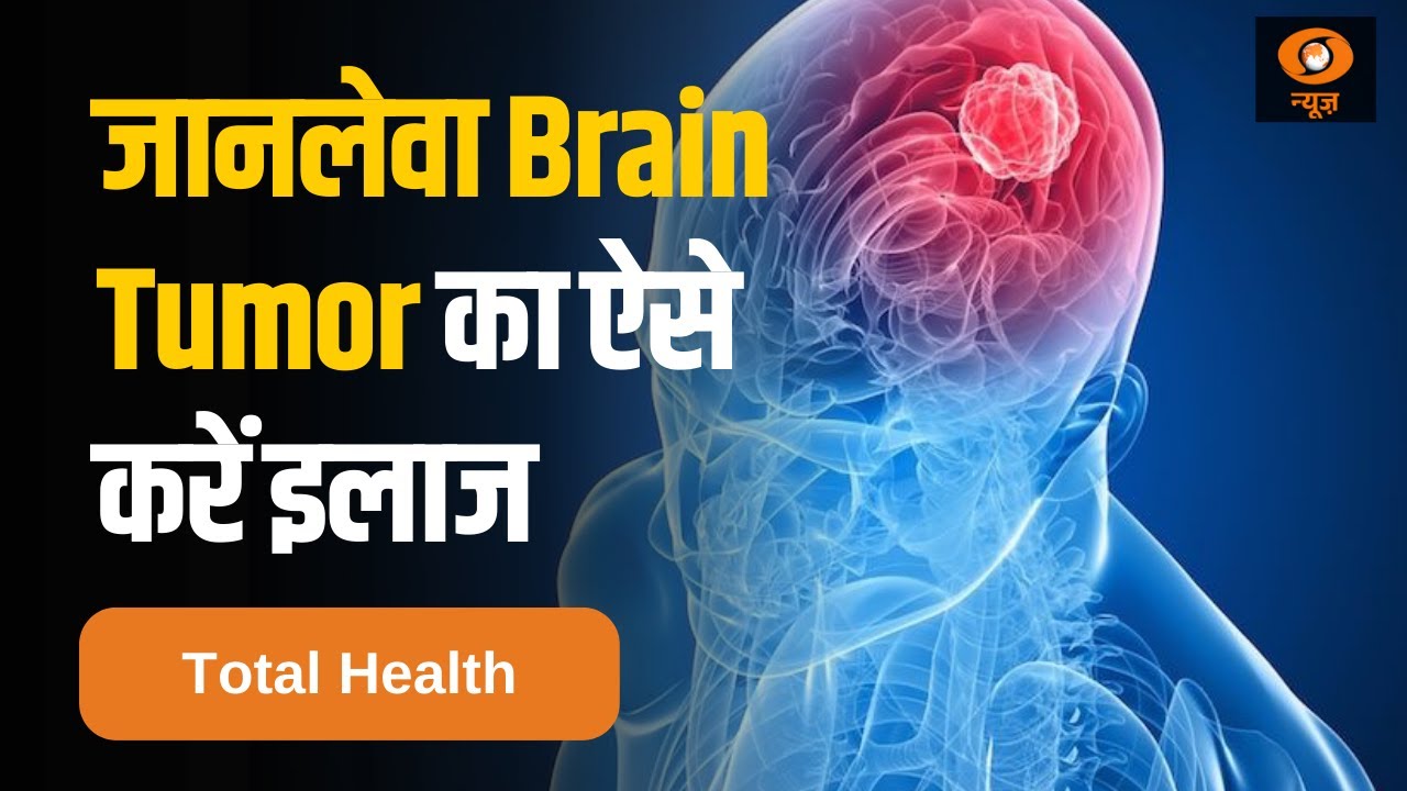 जानिए कैसे जानलेवा Brain Tumor का करें इलाज | Brain Cancer | Total Health