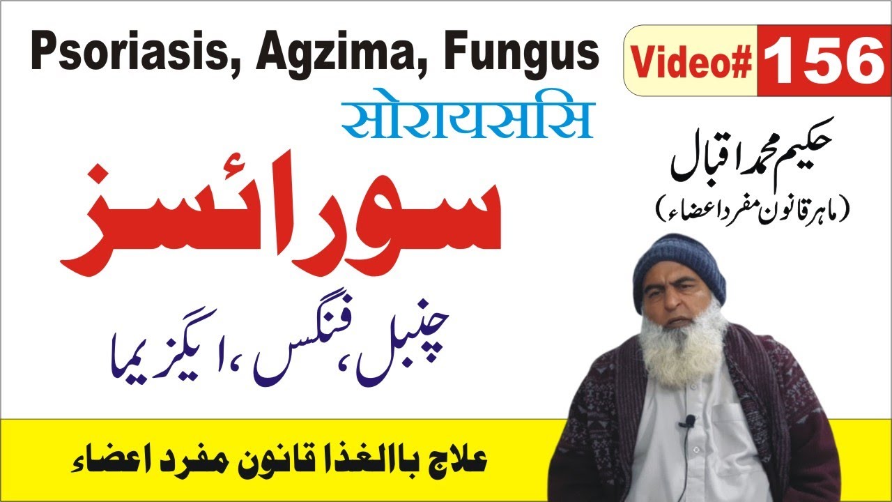 Psoriasis Agzima Fungus  || #156  ||  सोरायसिस  || سورائسز چنبل فنگس ایگزیما || Al Huda
