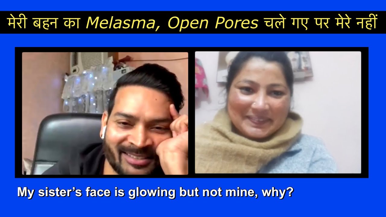 My Sister’s Melasma, Open Pores gone but not mine. Her Face is Glowing but not mine. Why?