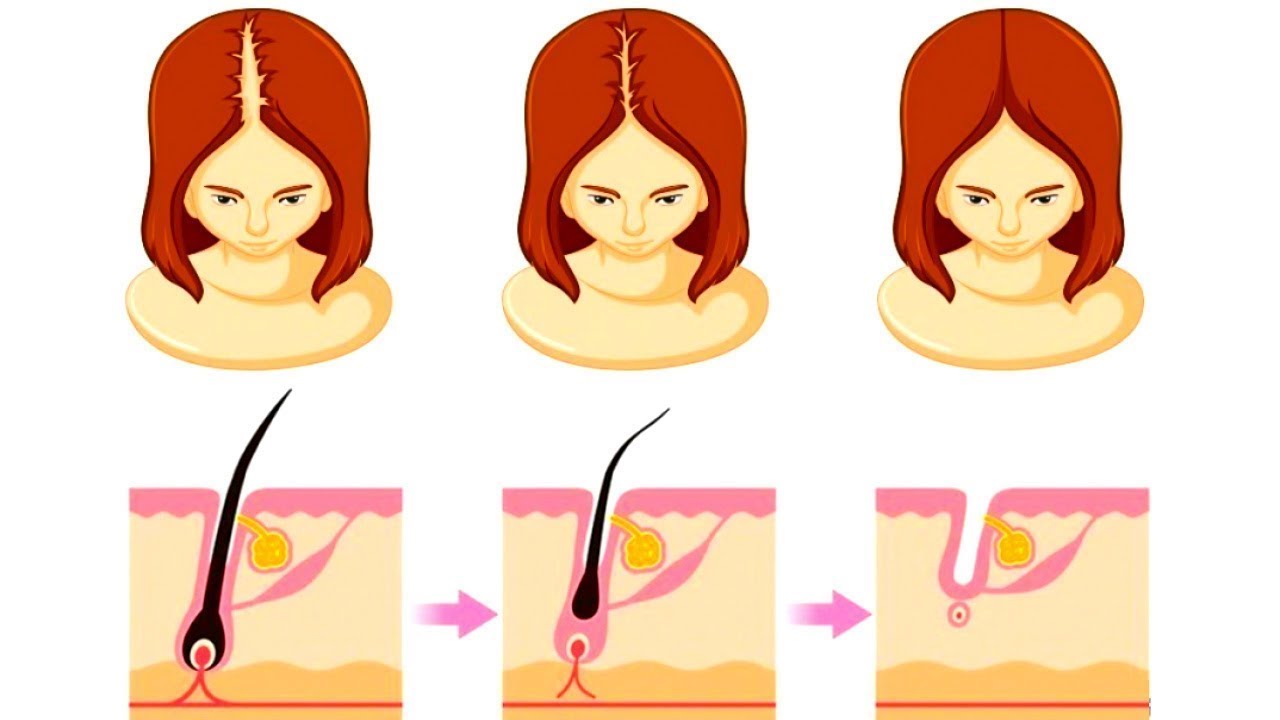 20 Habitudes Pour Des Cheveux Forts et en Bonne Sant&eacute;