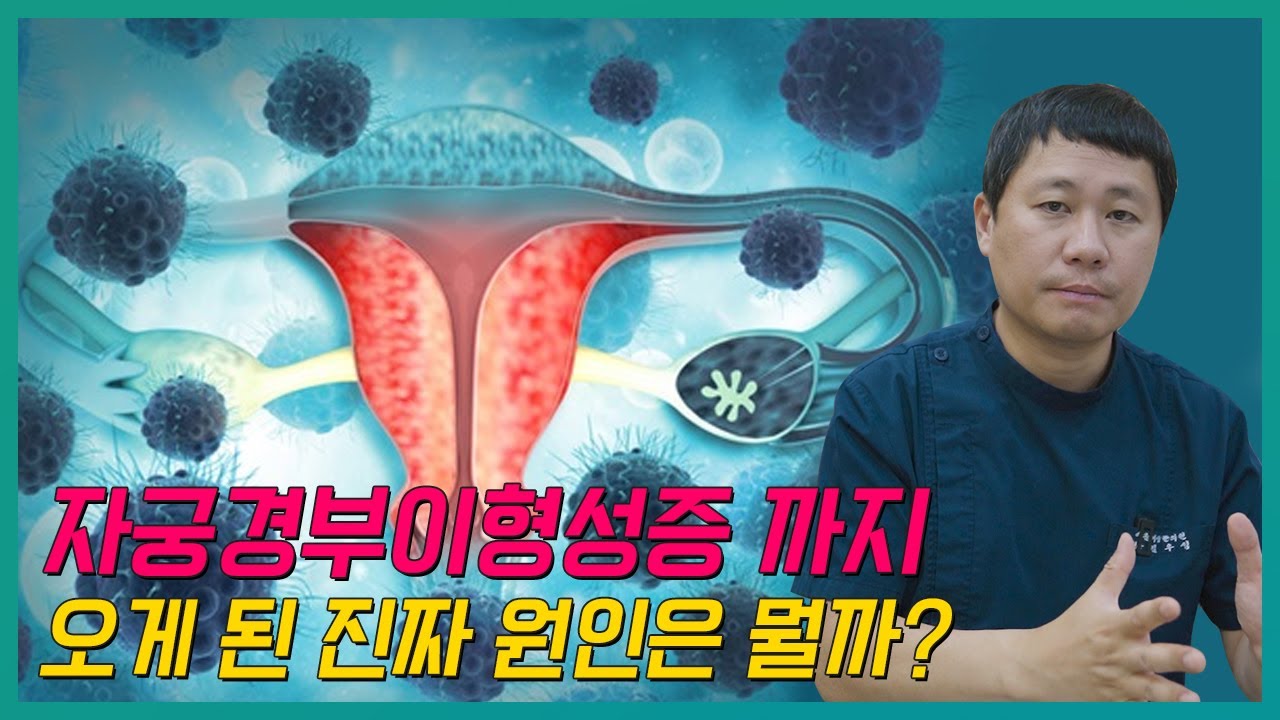 자궁경부이형성증 원인, 왜 나는 자연 소멸이 안 될까요?