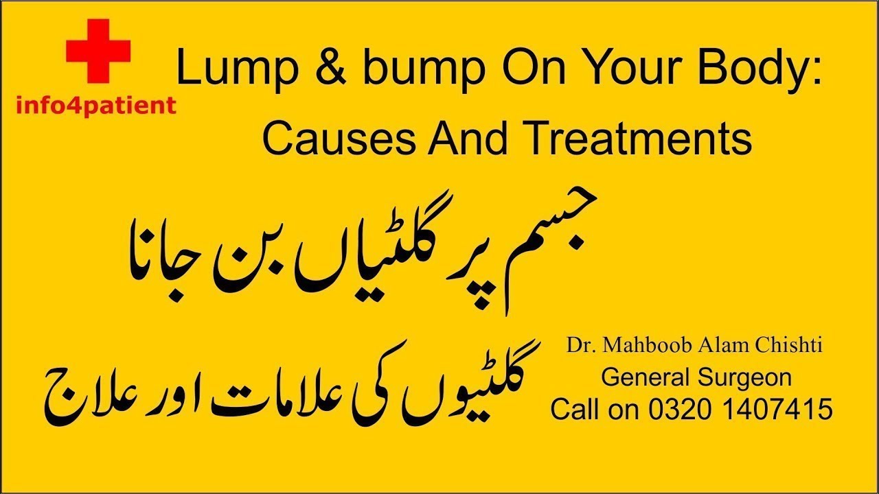 Jism Par Giltian Lump & Bump On Your Body- جسم پر گلٹیاں بن جانا | Doctor Mahboob alam chishti