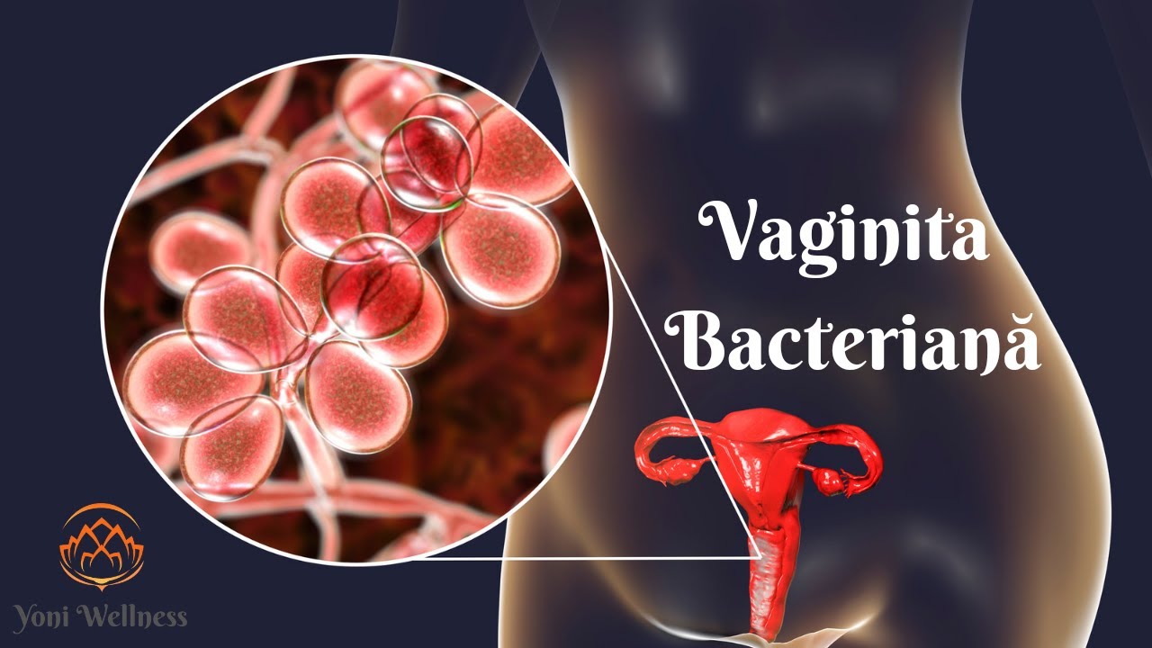 S2. Ep 36 - Infecția cu Escherichia Coli | Klebsiella | Enterococ | Proteus | Vaginita Bateriană