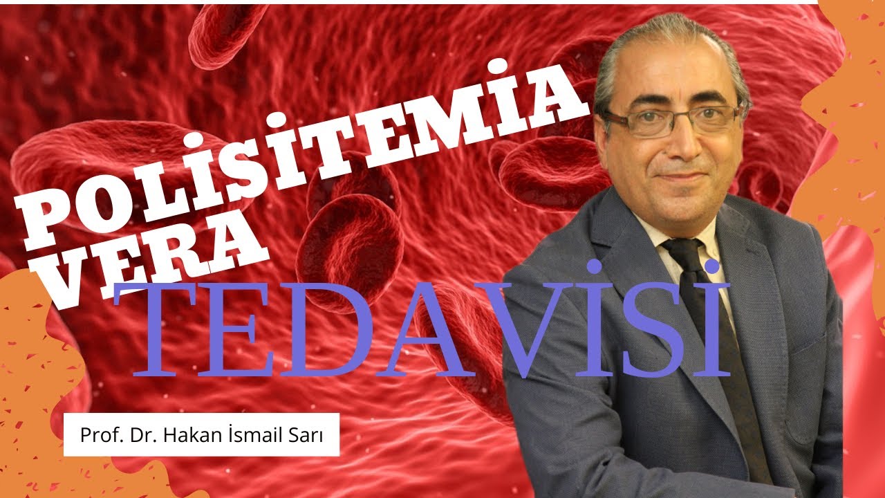 Polisitemia Vera Tedavisi / Polisitemia Vera Nasıl Geçer?
