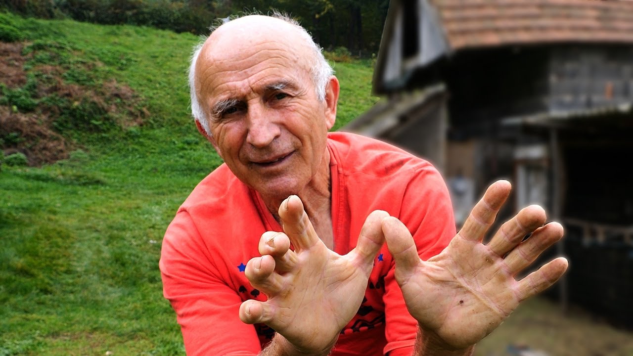 Preživio udar struje od 20.000 volti