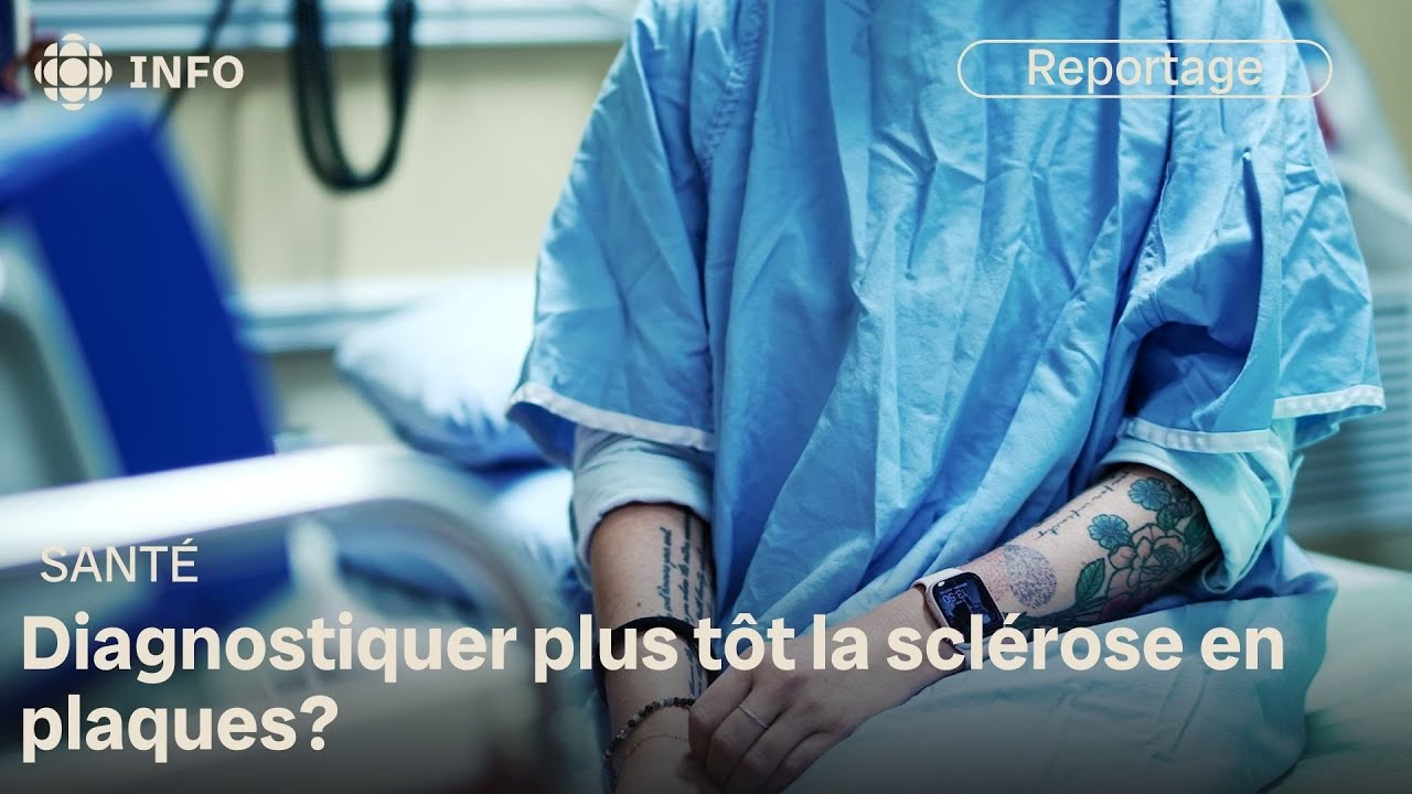 Scl&eacute;rose en plaques : des signes bien avant le diagnostic