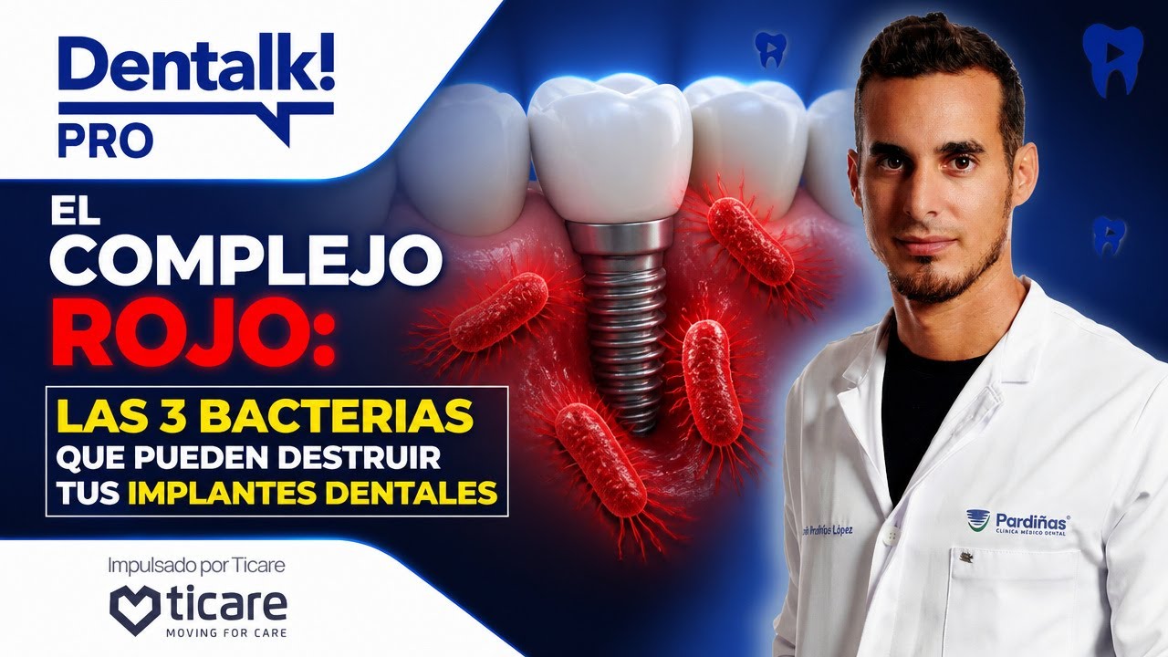 El complejo rojo: las 3 bacterias que pueden destruir tus implantes dentales