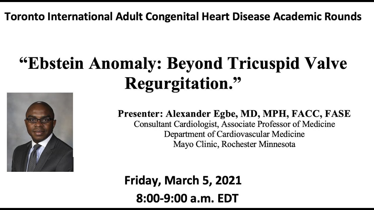 Ebstein Anomaly: Beyond Tricuspid Regurgitation
