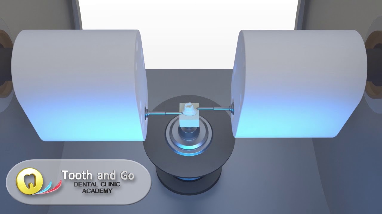 Zirconia implant abutment in the Philippines-Tooth & Go