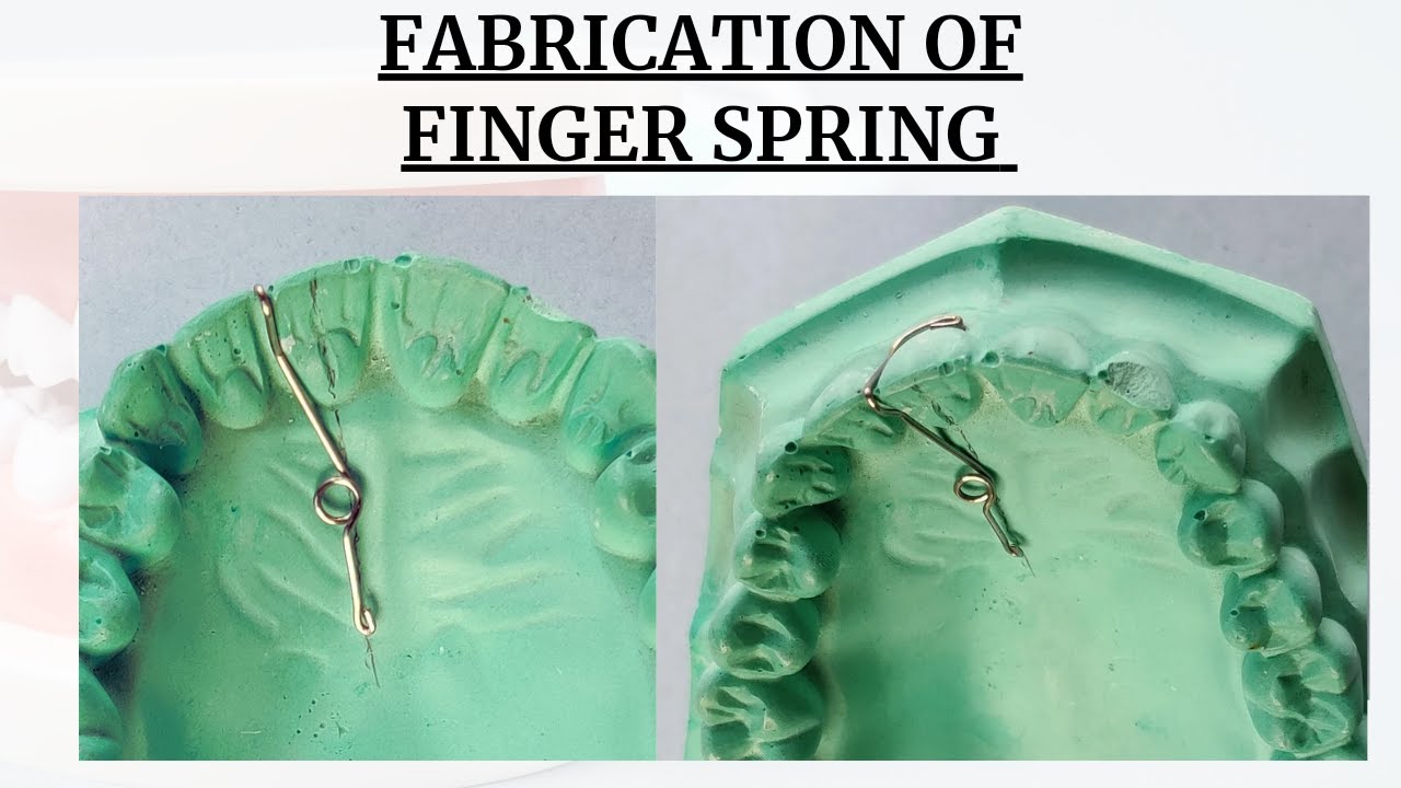 #fingerspring Fabricaton Of Finger Spring Stepwise | Single Cantilever Spring | Dentocare