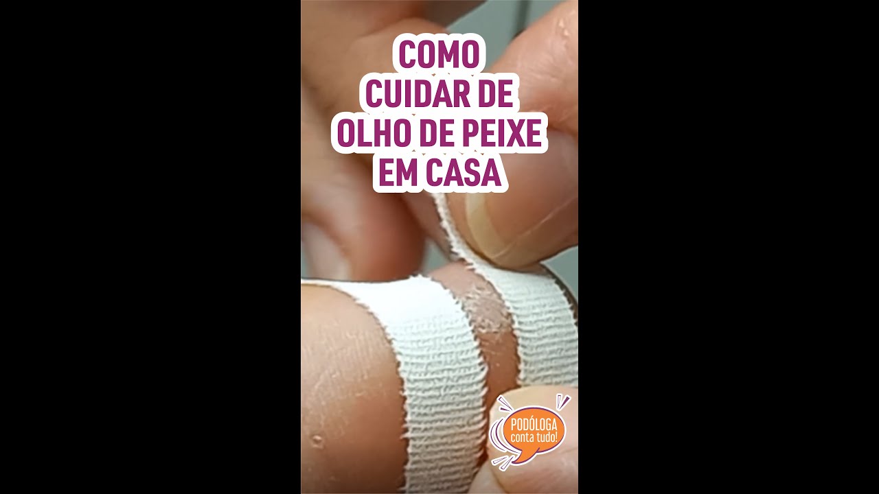#short COMO CUIDAR DE OLHO DE PEIXE EM CASA