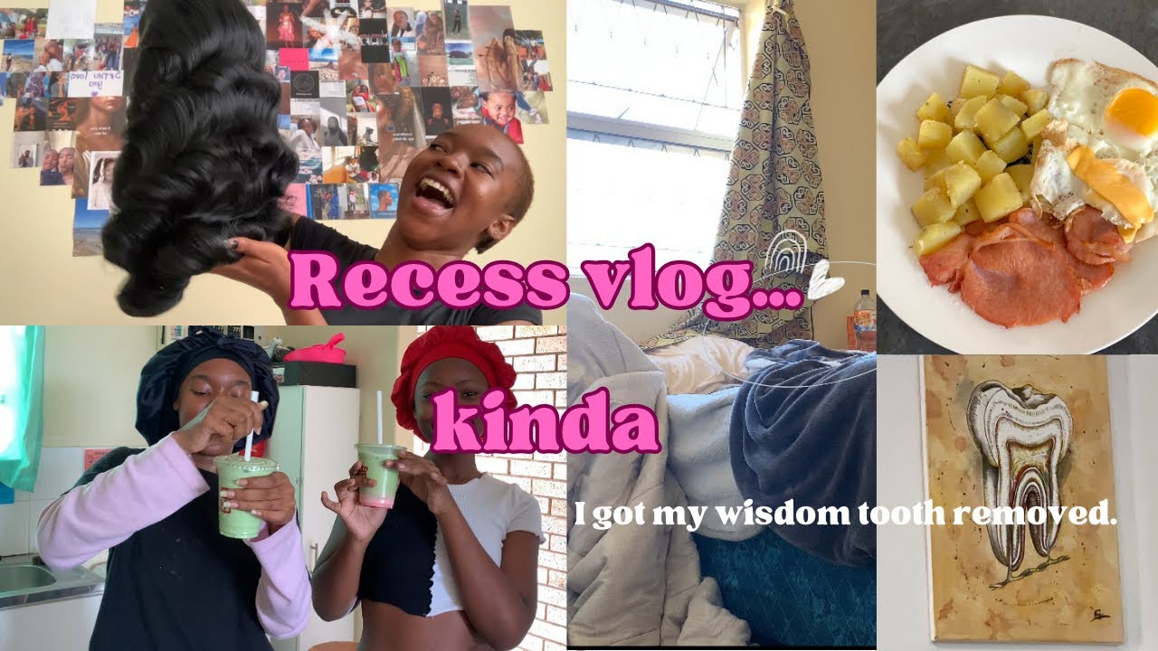🦷Wisdom Tooth Out, Matcha Latte & Wig Unboxing! ✨ | Recess Break Vlog