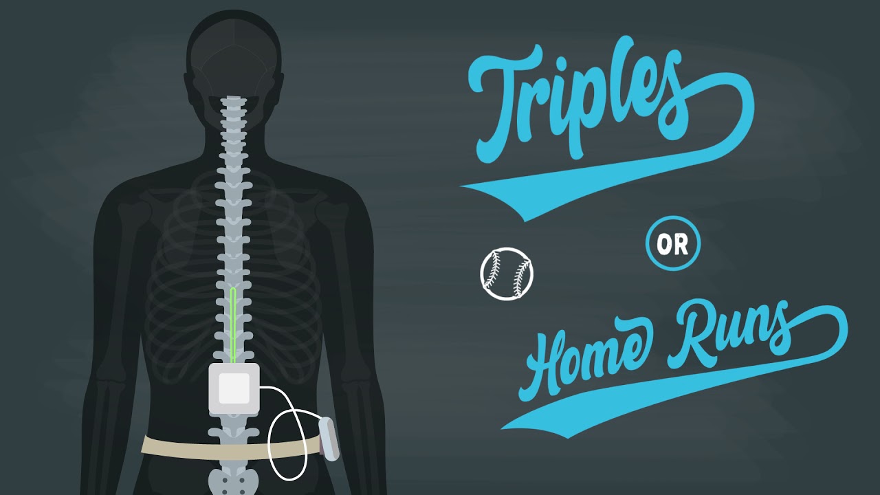Spinal Cord Stimulation