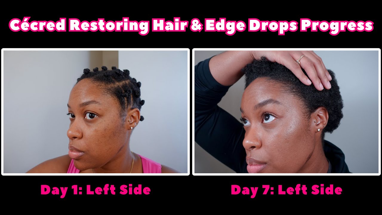 Cécred Restoring Hair & Edge Drops | Прогресс за 1 неделю | @cecred