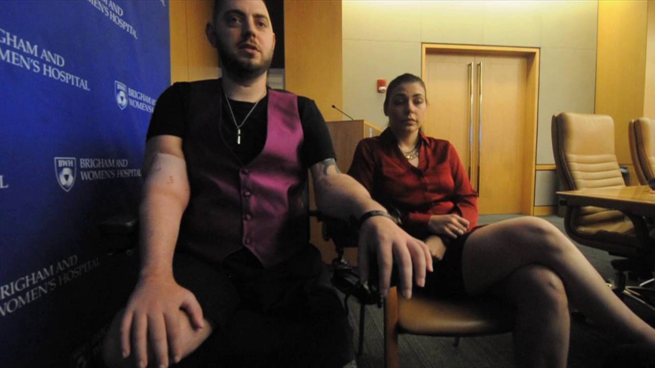Marine John Peck, has double arm transplant
