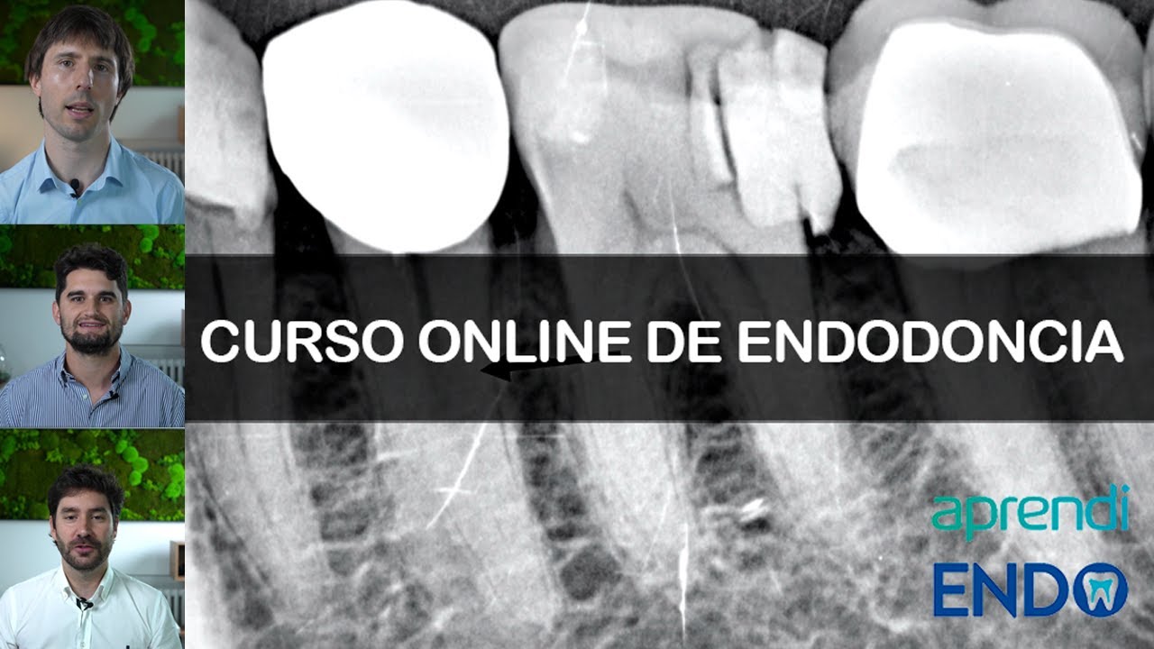 Curso de endodoncia Online AprendiENDO