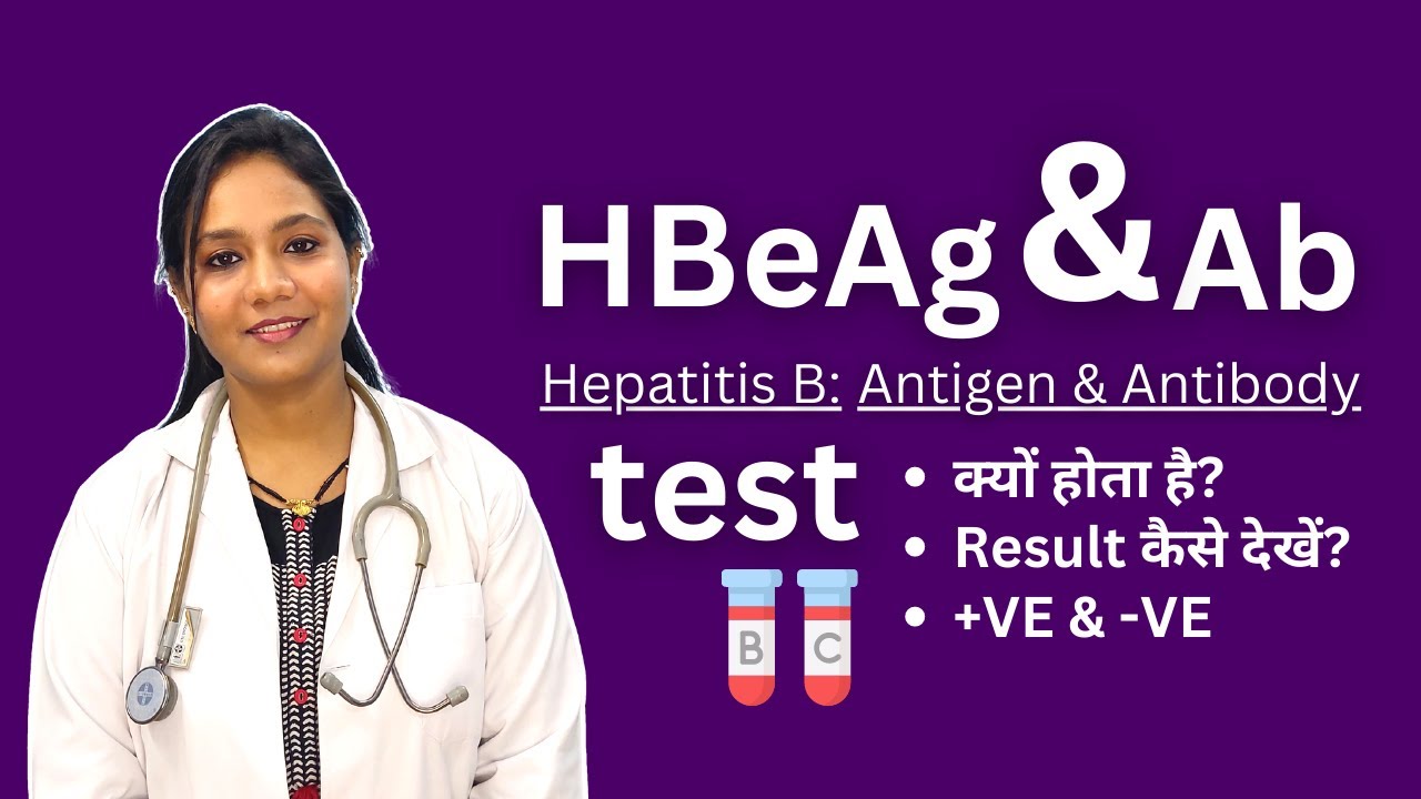 HBeAg and Antibodies Test in Hindi | Positive, Negative Result Analysis