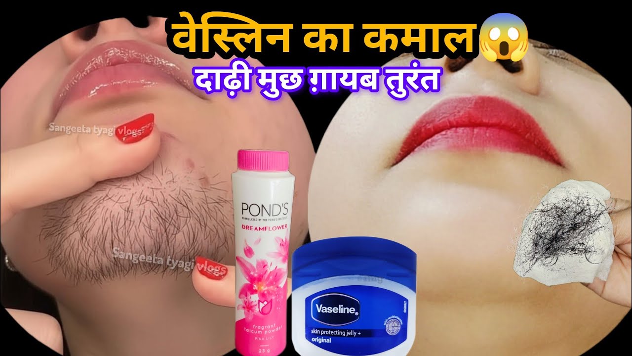 तुरंत रिजल्ट एक चुटकी पाउडर से मेरे फेस के बाल ऐसे साफ जैसे कभी थे ही नहीं || Hair Removal at Home