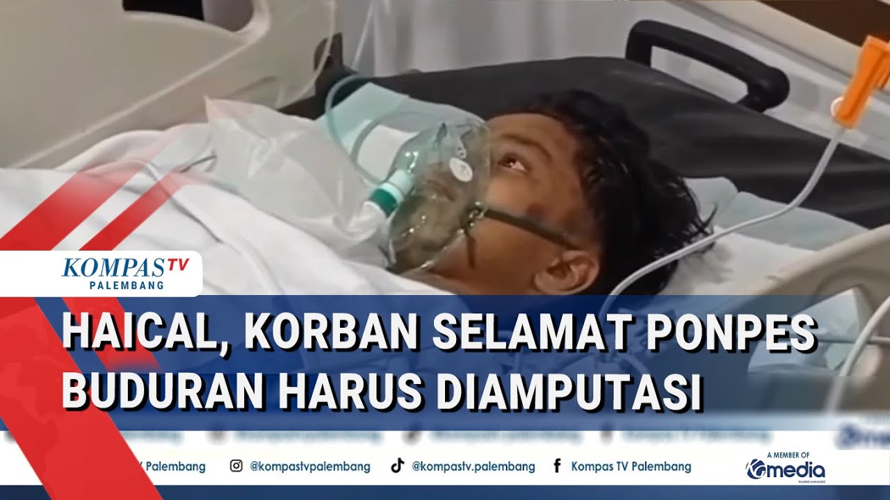 Pilu! Haical, Korban Selamat Ponpes Buduran Al Khoziny, Harus Diamp*tasi