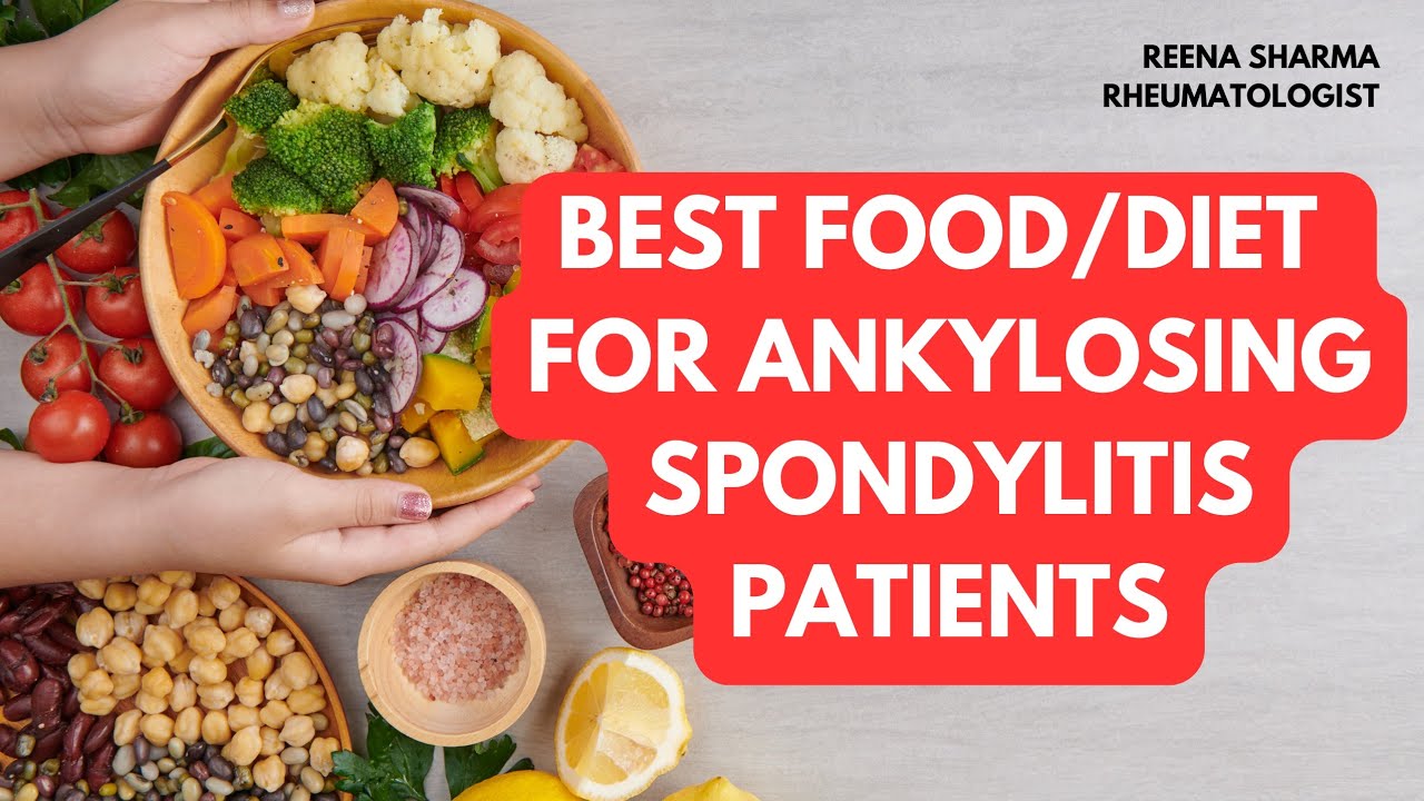 #50 एंकिलॉजिंग स्पॉन्डिलाइटिस के मरीज क्या खा सकते हैं? | DIET FOR ANKYLOSING SPONDYLITIS PATIENTS