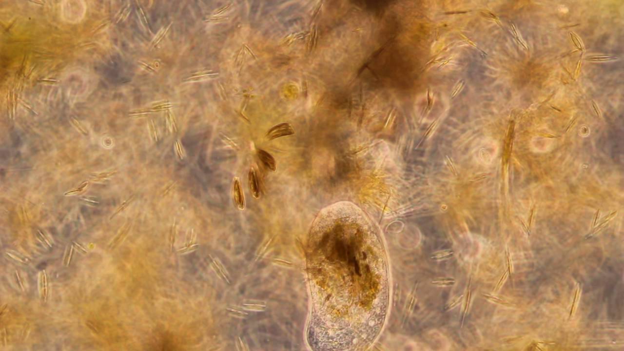 Mikroskopierter Biofilm (Bewuchs): Algenfressendes Wimperntier kotet ab