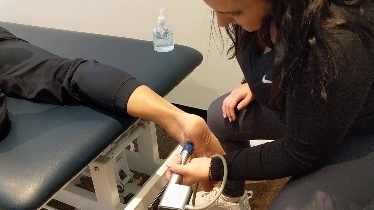 Shockwave Therapy for Plantar Fasciitis - Propel Physiotherapy