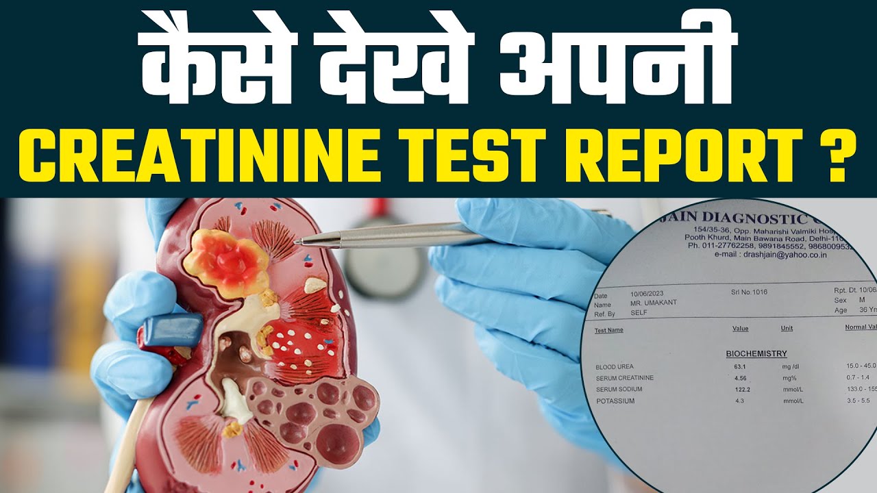 क्रिएटिनिन क्या होता है ? Creatinine Test Report कैसे देखते है | Creatinine Clearance Test