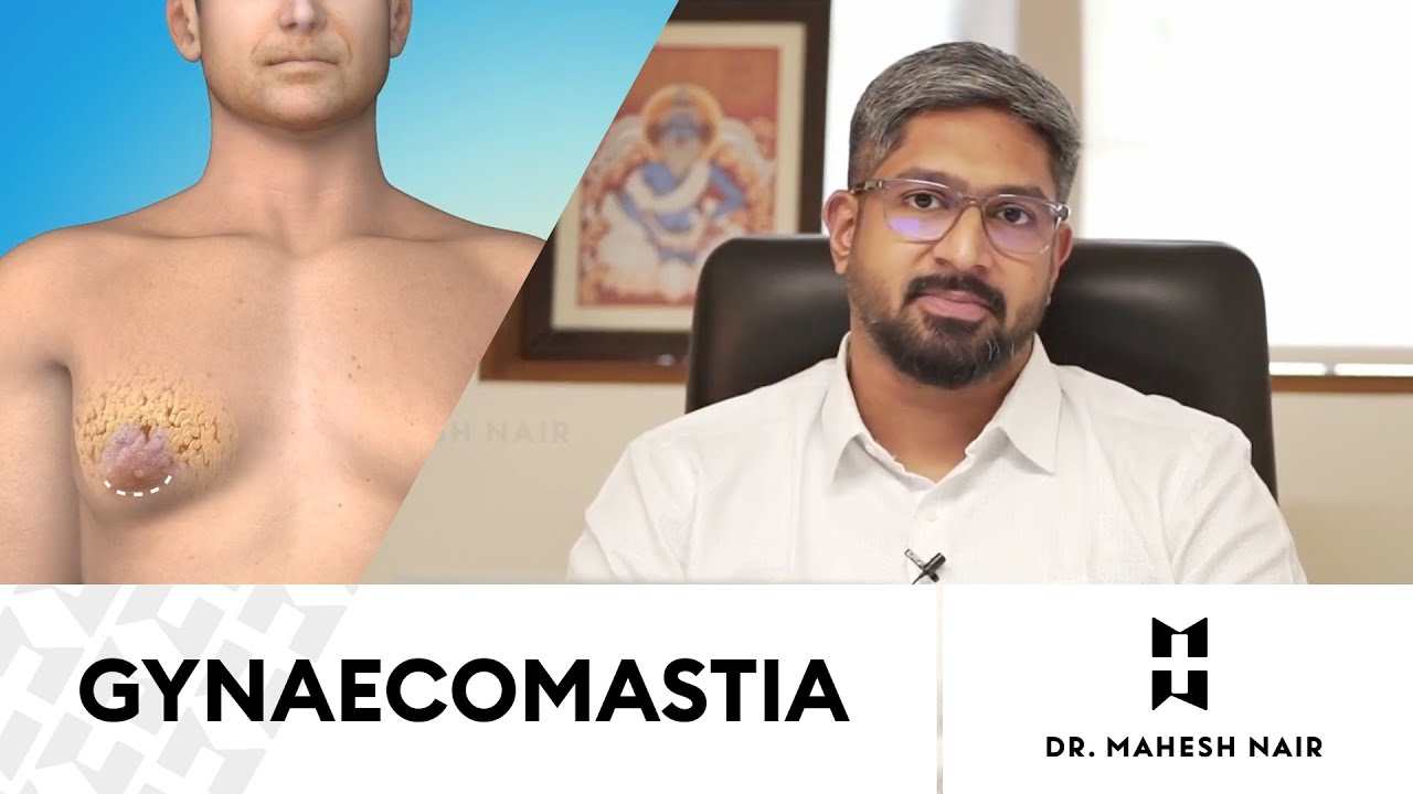 Gynecomastia / Man Boobs in Kerala | Dr.Mahesh Nair | Plastic Surgeon