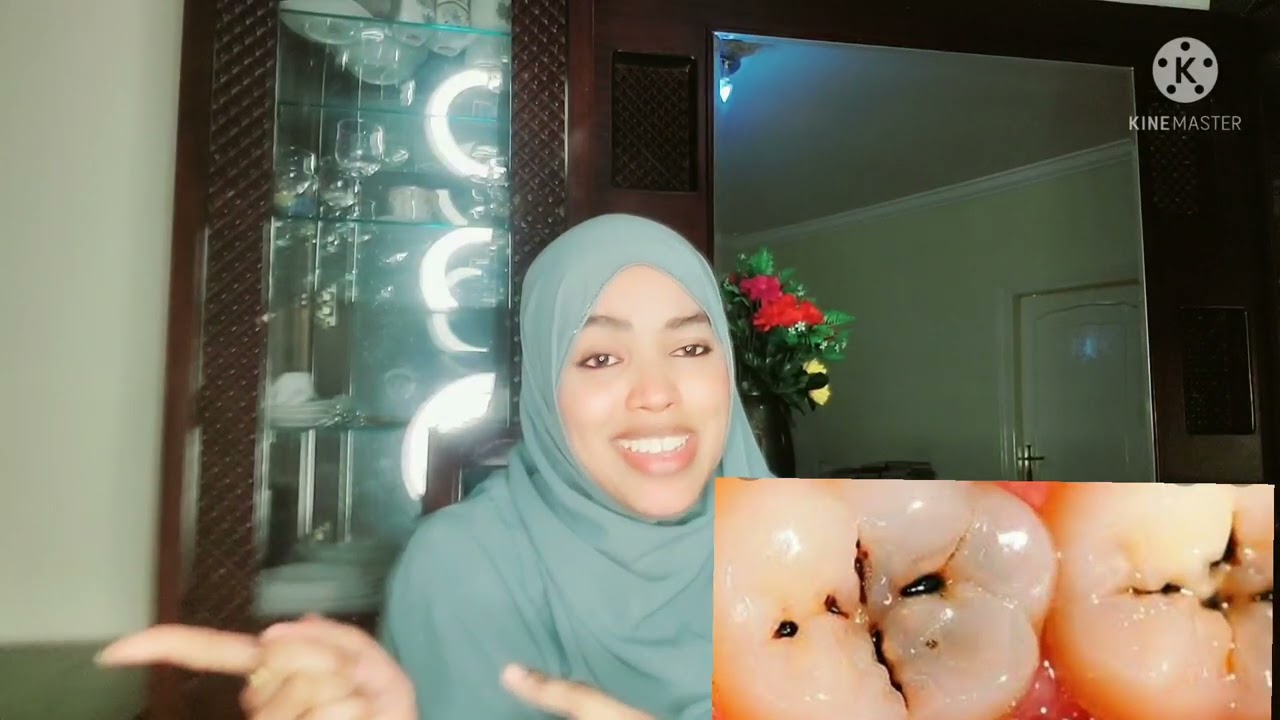 SUUSKA ILKA SIDEED UGA DAWEYN KARTA...  SI UUNA SUUSKU DHUUXA ILIGA Una  UGADHIIN 👇👇WATAN JAWABTI