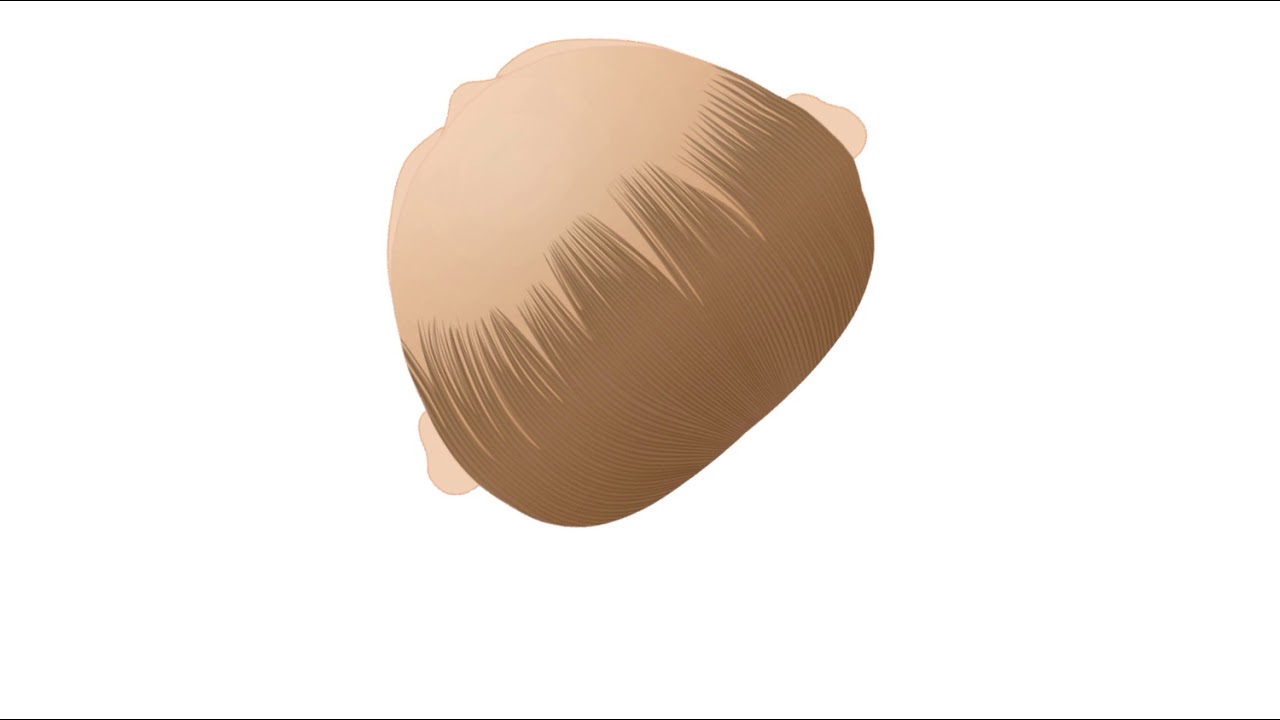 Flat head treatment with the Tortle